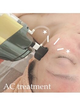 エムアンドエム(M&M)/