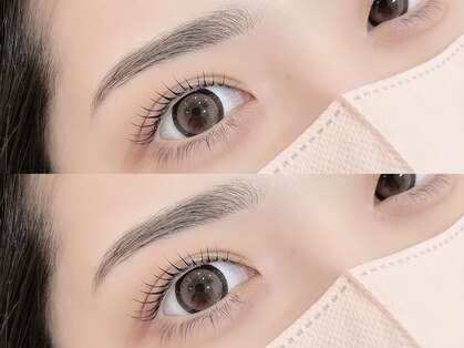 ミニョン(mignon)の写真