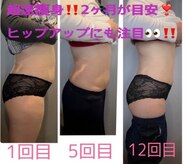 ビオナス(BIONAZ)