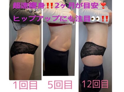 ビオナス(BIONAZ)の写真
