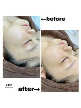 アプ(APP.)/本格シェービングbefore→after