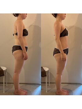 ラナ 京都西院店(Lana)/猫背・巻き肩の改善に◎