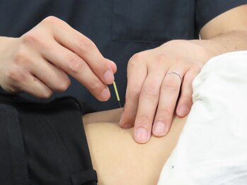 よつば治療院/はり灸施術風景