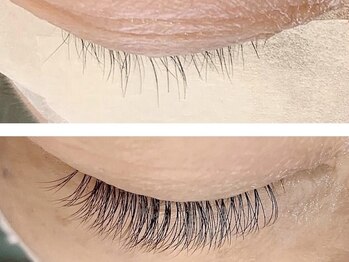 カンロ(kanro)の写真/《加齢によるボリュームダウンが気になる方へ》エイジングケア!40~60代の方からもリピ―トされています☆