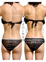 ロイヤルキューティー アンド 介正アップ美容整体院 博多店(ROYAL QT)/ハイパーナイフ90分