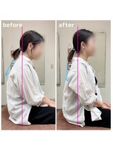 ぎふ駅前整体院/ひどい首肩こり、頭痛でお悩み