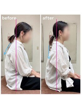 ぎふ駅前整体院/ひどい首肩こり、頭痛でお悩み