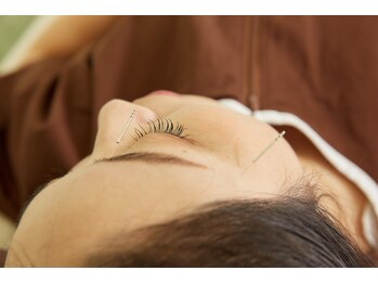 リファイン治療院の写真/スマホやデスクワークで目の疲れを感じる方、暑さで熟睡できていない方にもおすすめ！