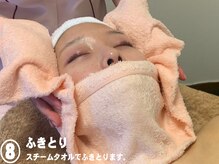 ビューネット(BEAUNet)/8.ふきとり