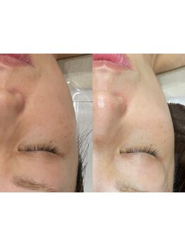 お肌をきれいにしたい