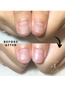 プラスワン(+1)/ハンド深爪矯正(初回長さ出し)