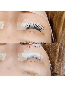 ニカ(Nica)/バインドロック