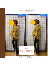 あらかき接骨院/【姿勢の変化】