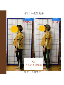 あらかき接骨院/【姿勢の変化】