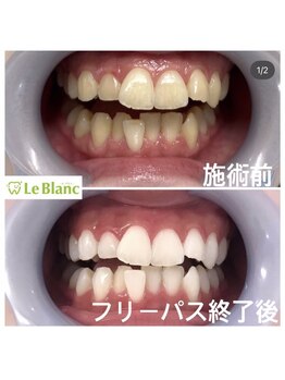 ルブラン 奈良店(Le Blanc)/食事制限無し!