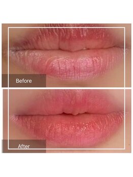 リリーガーデン 手稲店(Lily Garden)/before after【ローマピンク】