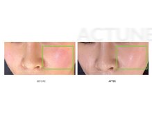 サロンドオフ 御堂筋店(salon de off)/