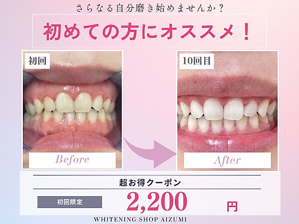 ホワイトニングショップ 徳島藍住店｜ホットペッパービューティー
