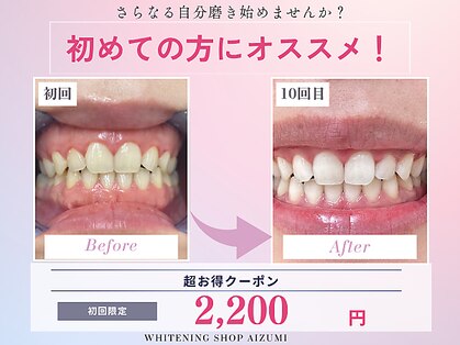 ホワイトニングショップ 徳島藍住店の写真