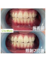 ルブラン 奈良店(Le Blanc)/お兄さまの結婚式に向けて。。。