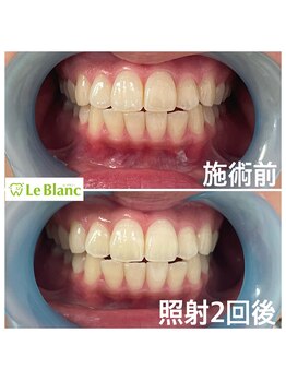 ルブラン 奈良店(Le Blanc)/お兄さまの結婚式に向けて。。。