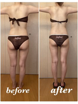 アンフィニ(infini)/短期集中コース10回(3か月)