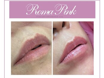 ニコリ 大宮(NICORI)/【ローマピンク】正規導入店舗