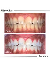 シュシュ(chouchou)/高濃度医療提携機関ジェル比較