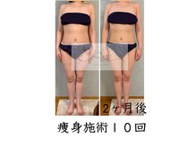 アイ エステサロン(Ai)/【20代】お腹・太ももスッキリ！