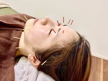 リアライズ(realise)の雰囲気（小顔・たるみ・しわ・しみ・ニキビ・毛穴など肌悩みを根本改善！）