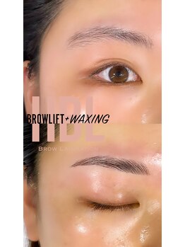 グロー(Glow)/ハリウッドブロウリフト