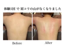ナチュラーレ 天王寺店(Naturale)/痩身リンパマッサージ二の腕美脚