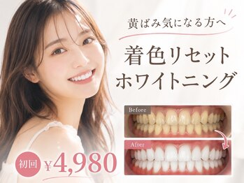 グリッター ショウナン(glitter. SHONAN)の写真/ホワイトニングが当たり前の時代だからこそ、結果を重視したい方へ!歯が白いだけで、第一印象もぐっとUP◎