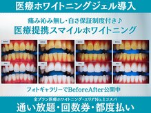 スマイルホワイトニング 赤羽店
