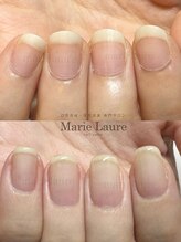 マリーロール 淀屋橋本店(Marie Laure)/自爪育成/深爪矯正/ネイルケア
