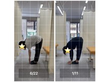 ナオル整体 飯田橋院(NAORU整体)/Before After/飯田橋/整体・矯正