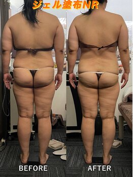 リラクゼーションサロン ラキ(laki)/特殊ジェル＋NR