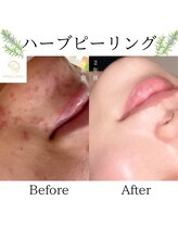 ココロ(COCORO)/継続は力なり