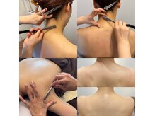 剃らないとソン 横浜店の雰囲気（ブライダル・背中シェービングでキレイな背中になりましょう♪）
