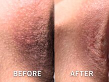 ドアディ(Doordie)/ローマピンク