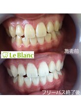 ルブラン 奈良店(Le Blanc)/イベント前に！