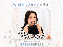 ホワイトニングサロン ホワイト 前橋店(WHITE)/5.歯茎にワセリンを塗布