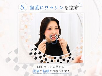ホワイトニングサロン ホワイト 前橋店(WHITE)/5.歯茎にワセリンを塗布