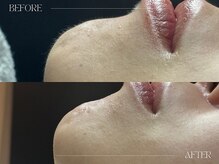 シェステ ゴジュウヨン(shesthe54)の雰囲気(自社開発のジェルで肌質改善しながらシェービング 国家資格保有)