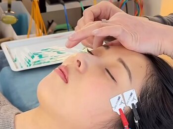 アオヤマ サロン ワイゼット(AOYAMA SALON YZ)の写真/【美容鍼が初めての方へ】歴20年・延べ6万人超の代表が毎回担当