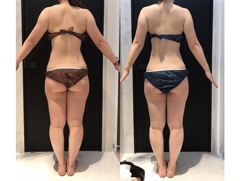 リボディ 表参道(An re Body)/before→after