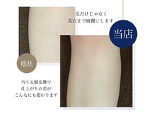 ハダハダ(HADA HADA Medical Esthetic)/毛穴まで綺麗に♪