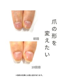 最強ネイルケア