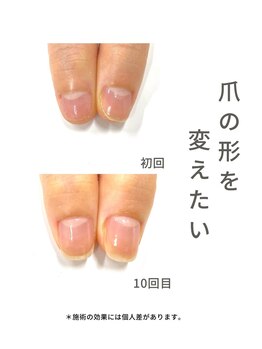 最強ネイルケア