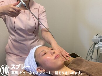 ビューネット(BEAUNet)/10.スプレー